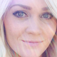Illustration for article titled Woman's Shocking Selfie Shows What Skin Cancer From Tanning Looks Like